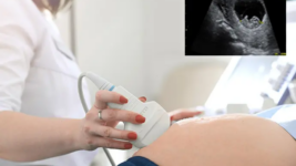 Heilbrigðisráðherra boðar umfangsmikla endurskoðun á lögum um tæknifrjóvgun